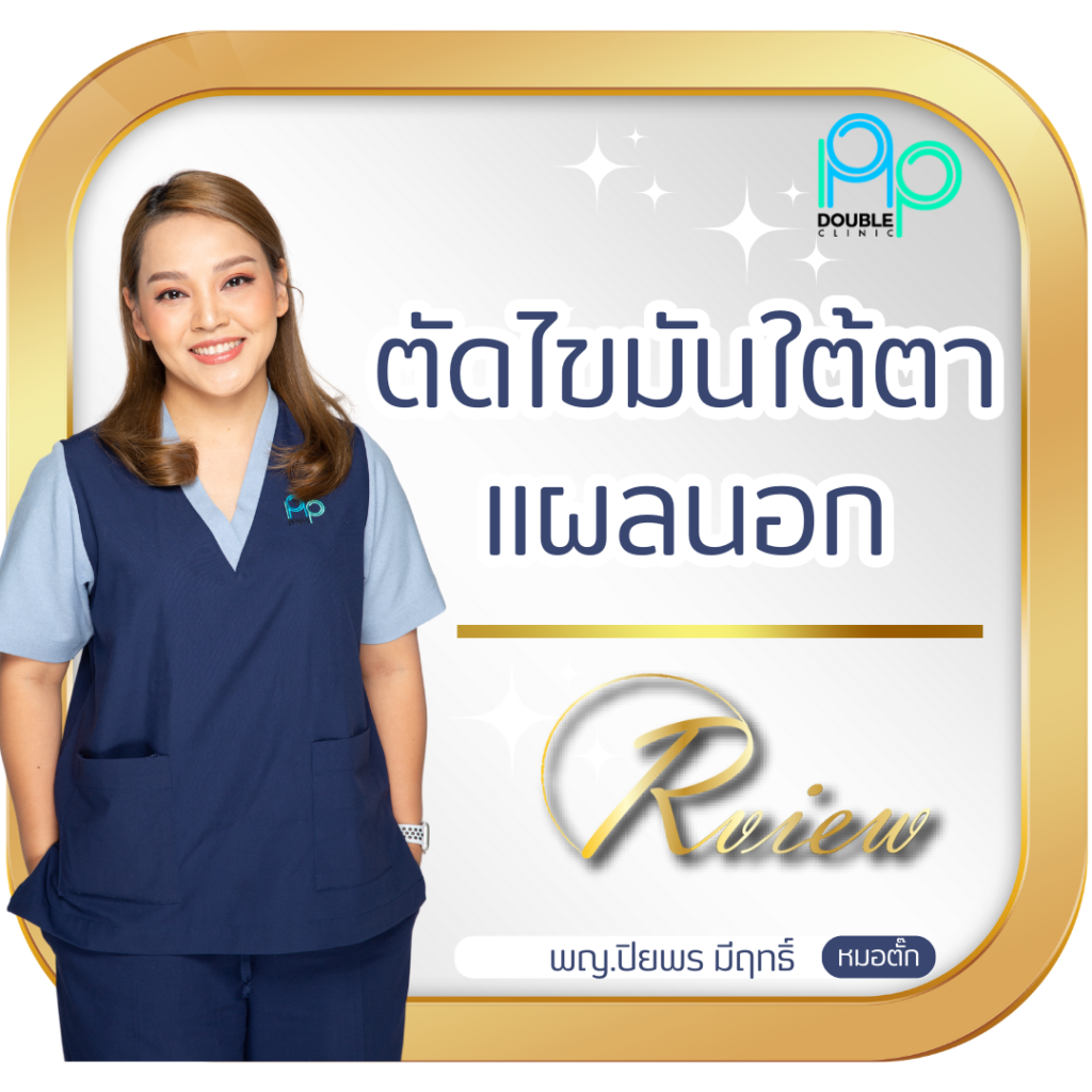 ตัดไขมันใต้ตา แผลใน