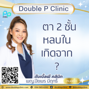 ตา 2 ชั้นหลบใน เกิดจากอะไร